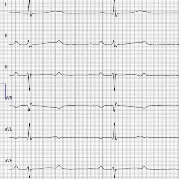 Ruhe-EKG-Untersuchung eines Patienten