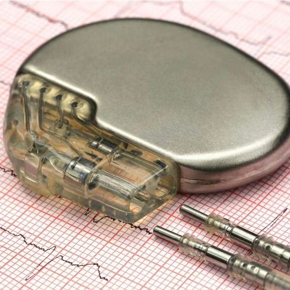 Herzschrittmacher und Elektroden auf einem EKG-Diagramm zur Überwachung und Unterstützung der Herzfunktion.