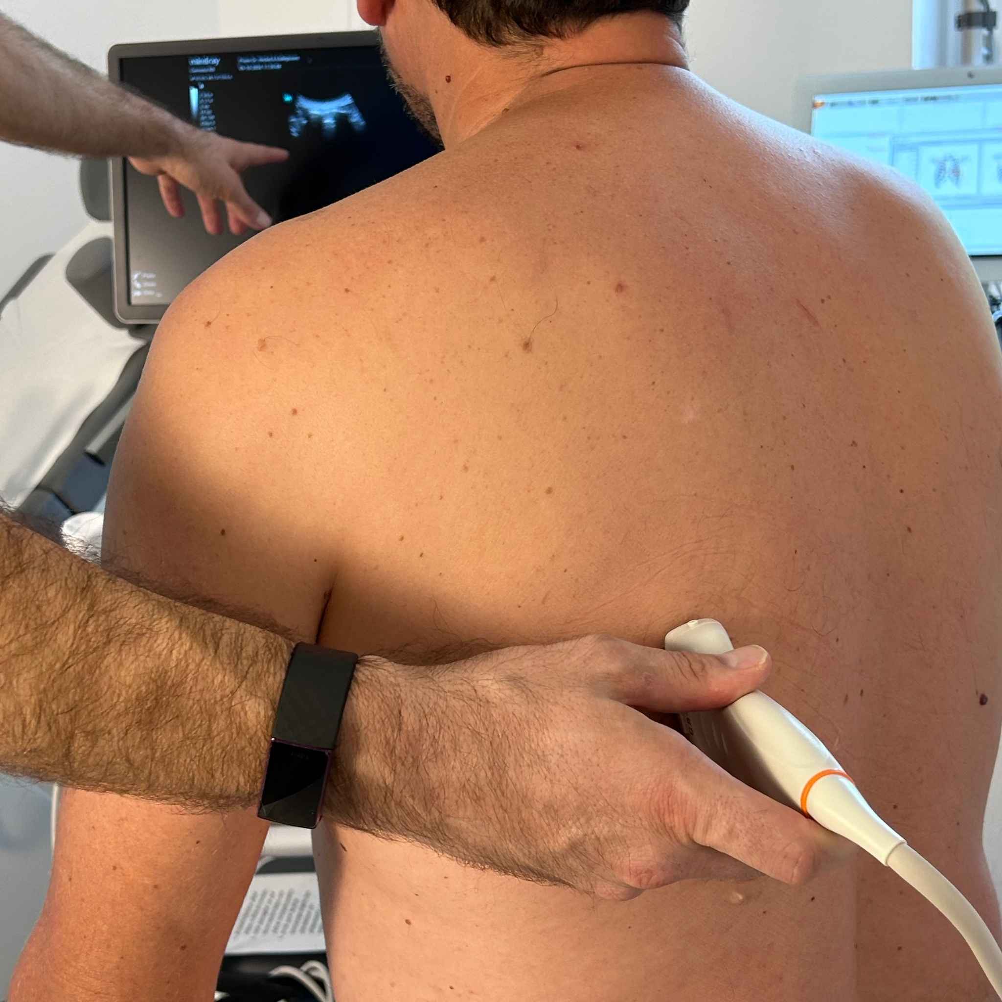 Arzt führt eine Thoraxsonografie durch, wobei ein Ultraschallgerät zur Untersuchung von Lungen und Rippenfell eingesetzt wird.